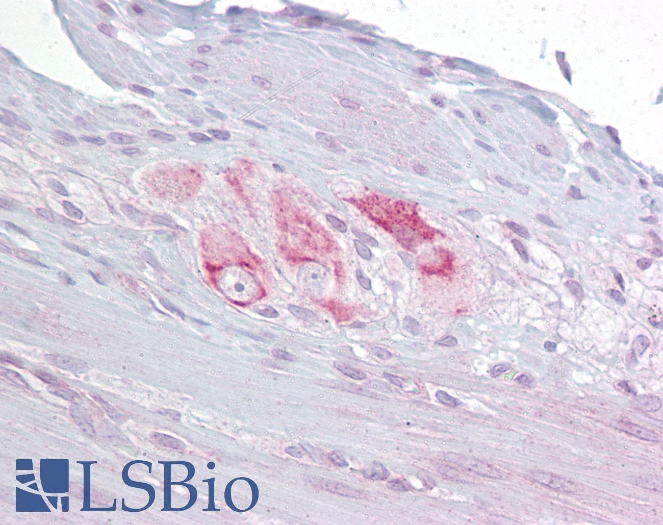 RBMS3 Antibody (C-Terminus)