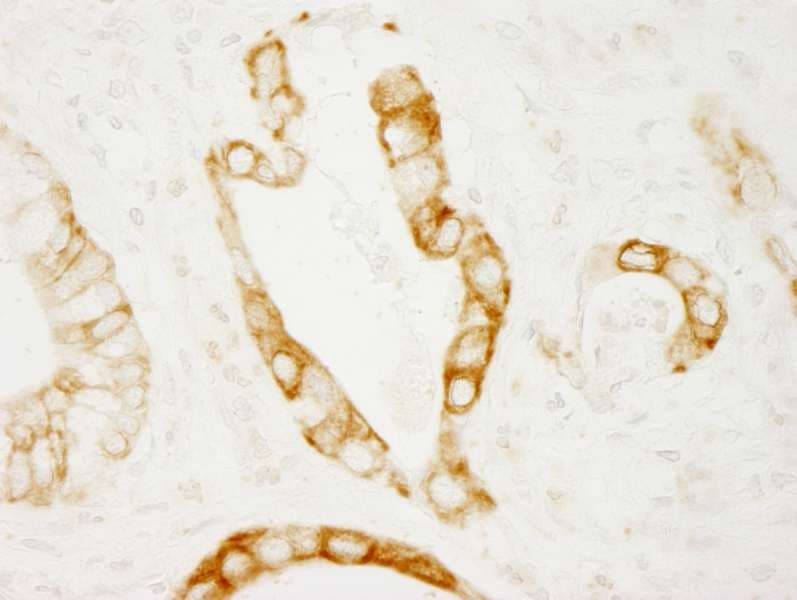 PRKD2 / PKD2 Antibody (aa825-C-term)