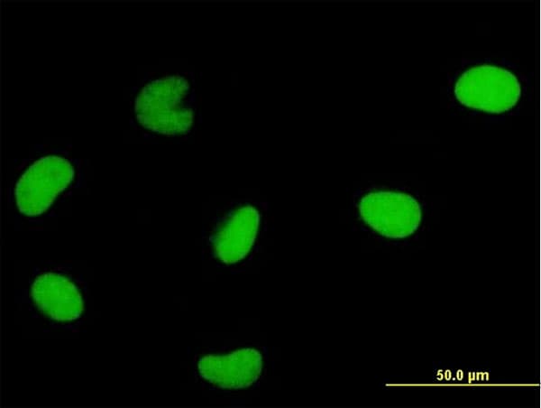 IHC-plus™ DUT / DUTPase Antibody (clone 1C9)