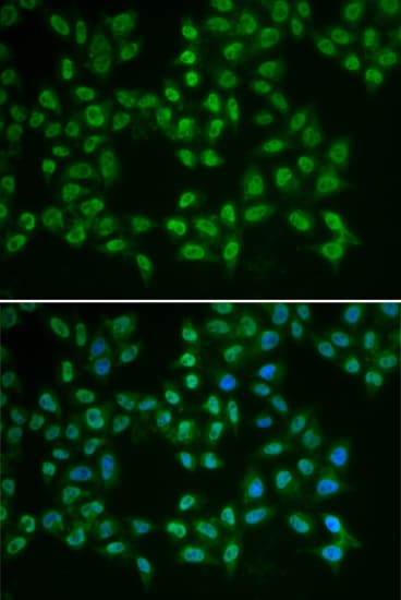 BTK Antibody