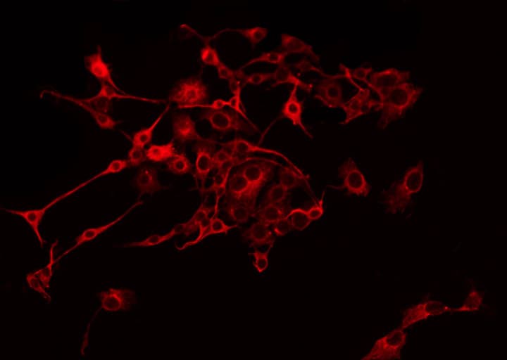 NDUFB9 Antibody