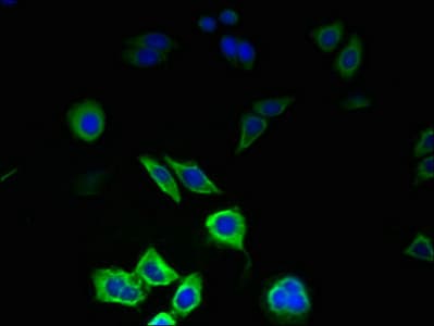 Polyclonal Rabbit anti-Human PIGC Antibody