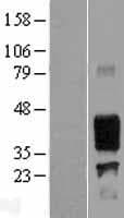 EMA / MUC1 Protein (Over-Expression Lysate Myc-DDK (Flag))