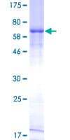 Human HAVCR1 / KIM-1 Protein (Recombinant GST)