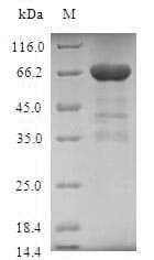 Human TMOD3 / Tropomodulin 3 Protein (Recombinant GST, N-terminus)