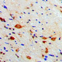 Polyclonal Rabbit anti-Human PRKACB Antibody (C-Terminus, IHC, WB)