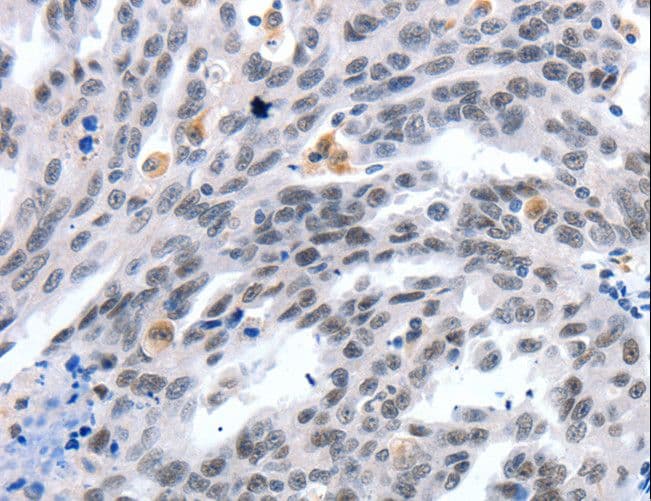 Polyclonal Rabbit anti-Human LRP5 Antibody (IHC)