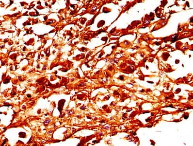Tyrosinase Antibody (aa19-377)