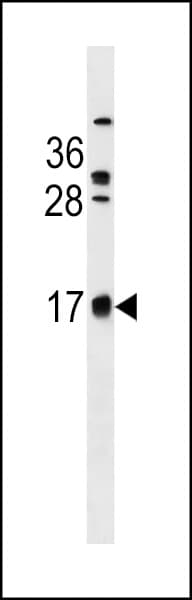 Polyclonal Rabbit anti-Human C2orf83 Antibody (aa111-138, WB)