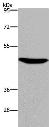 Polyclonal Rabbit anti-Human P2RX2 / P2X2 Antibody (IHC, WB)