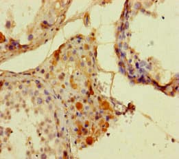 ATG16L2 Antibody