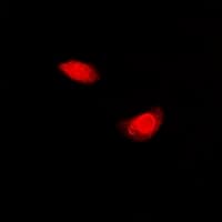 PPL / Periplakin Antibody