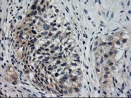 XPNPEP3 Antibody (clone OTI2D5)