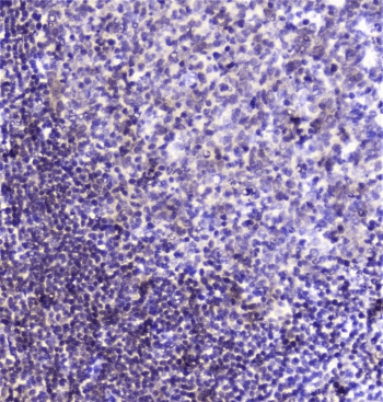 SP1 Antibody