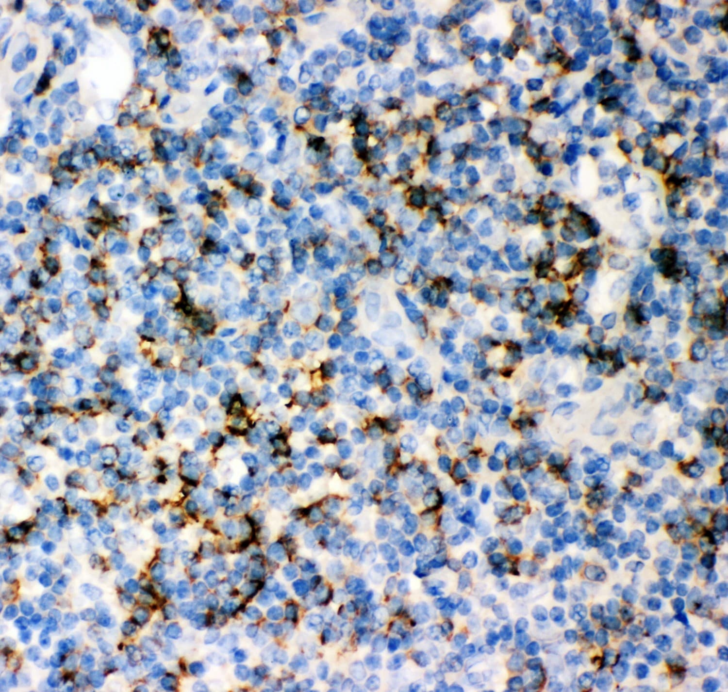 Polyclonal Rabbit anti-Human CD8A / CD8 Alpha Antibody (aa22-187, IHC, WB)