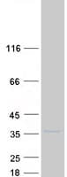 Human SLC25A33 Protein (Recombinant Myc-DDK (Flag))