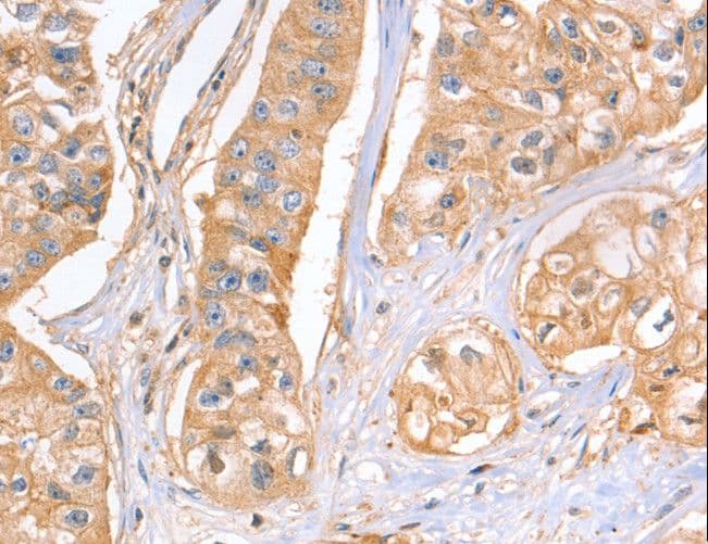 GNB1 Antibody