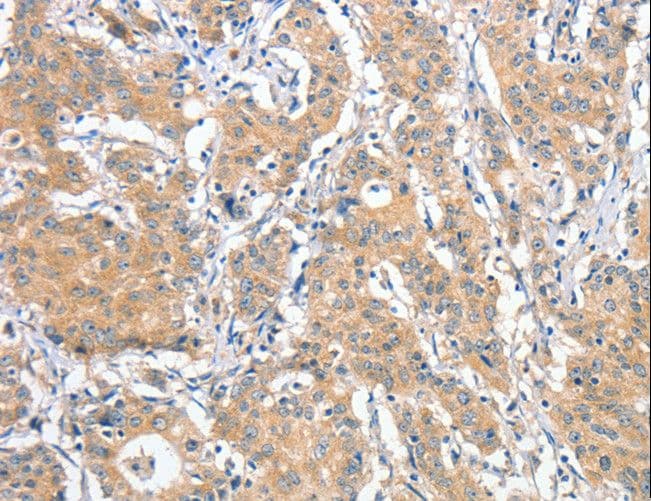 ANKMY2 Antibody