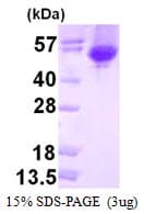 E. coli melA Protein (Recombinant His)
