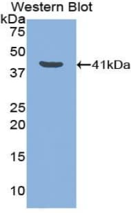 LF / LTF / Lactoferrin Antibody (aa28-351)