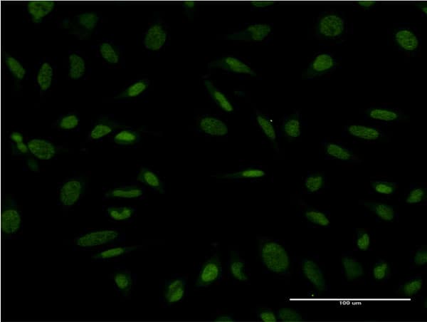 Monoclonal Mouse anti-Human PROX1 Antibody (clone 1E7, IF, WB)