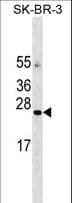 AGTRAP / ATRAP Antibody (aa133-159)