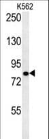 SLC4A7 Antibody (aa1186-1214)