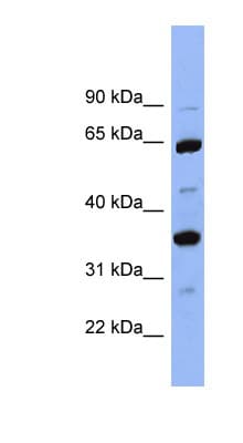 Polyclonal Rabbit anti-Human Antithrombin-III Antibody (aa143-192, IHC, WB)