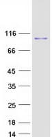 Human FACT / SSRP1 Protein (Recombinant Myc-DDK (Flag))