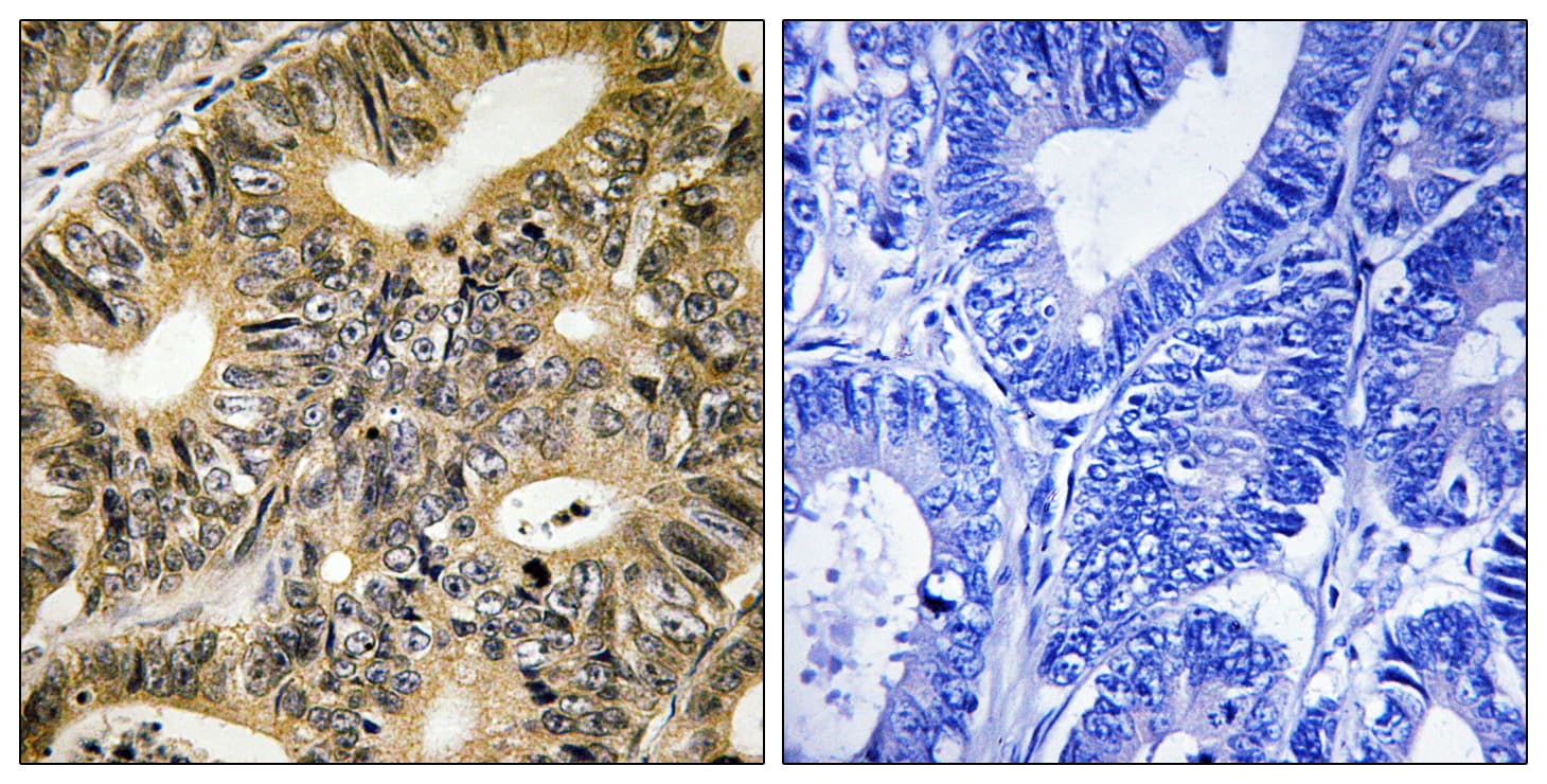 EIF4EBP1 / 4EBP1 Antibody (phospho-Thr70)