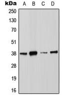 ANXA2 / Annexin A2 Antibody (phospho-Ser26)