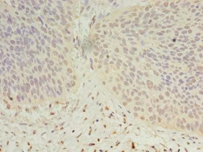 DHRS12 Antibody