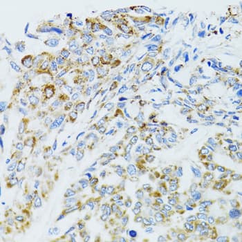 Polyclonal Rabbit anti-Human EGFR Antibody (IHC, IF, WB)