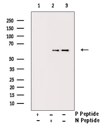 CAMK4 / CaMK IV Antibody (phospho-Thr196,pThr200)