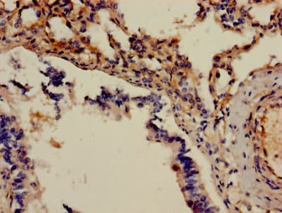 Polyclonal Rabbit anti-Human ADM / Adrenomedullin Antibody (aa45-92, IHC)