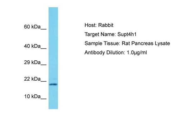 SUPT4H1 / SPT4 Antibody (aa57-106)