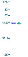Human CIB1 / KIP Protein (Recombinant GST)