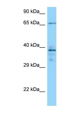 CAMK2G / CaMK II Gamma Antibody (aa390-439)