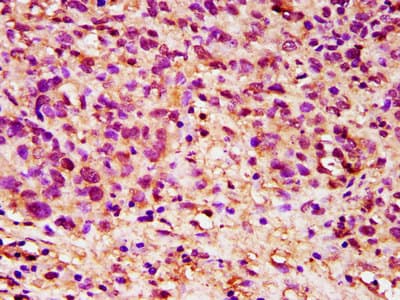 DPPA5 Antibody