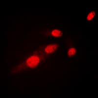 RELA / NFKB p65 Antibody (Acetyl-Lys310)