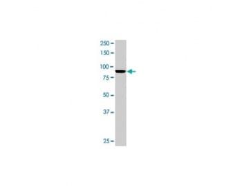 MAD1L1 / MAD1 Antibody (clone 9B10)