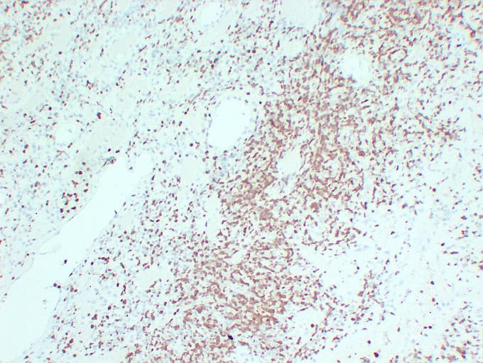 ZAP70 Antibody (clone ABT-ZAP70)