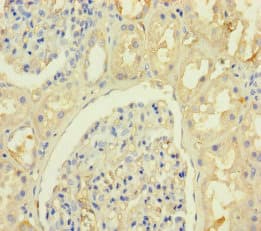 Polyclonal Rabbit anti-Human KRTAP8-1 Antibody