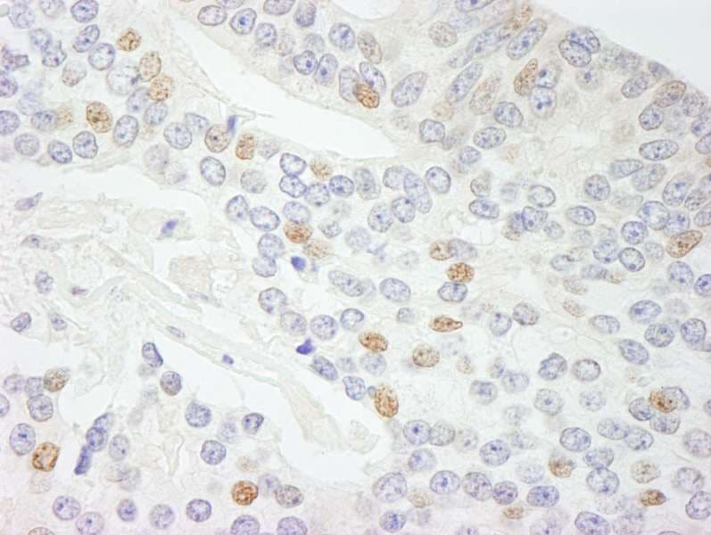 NCOA5 Antibody (aa1-50)