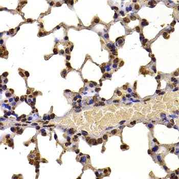 WHSC1 / NSD2 Antibody