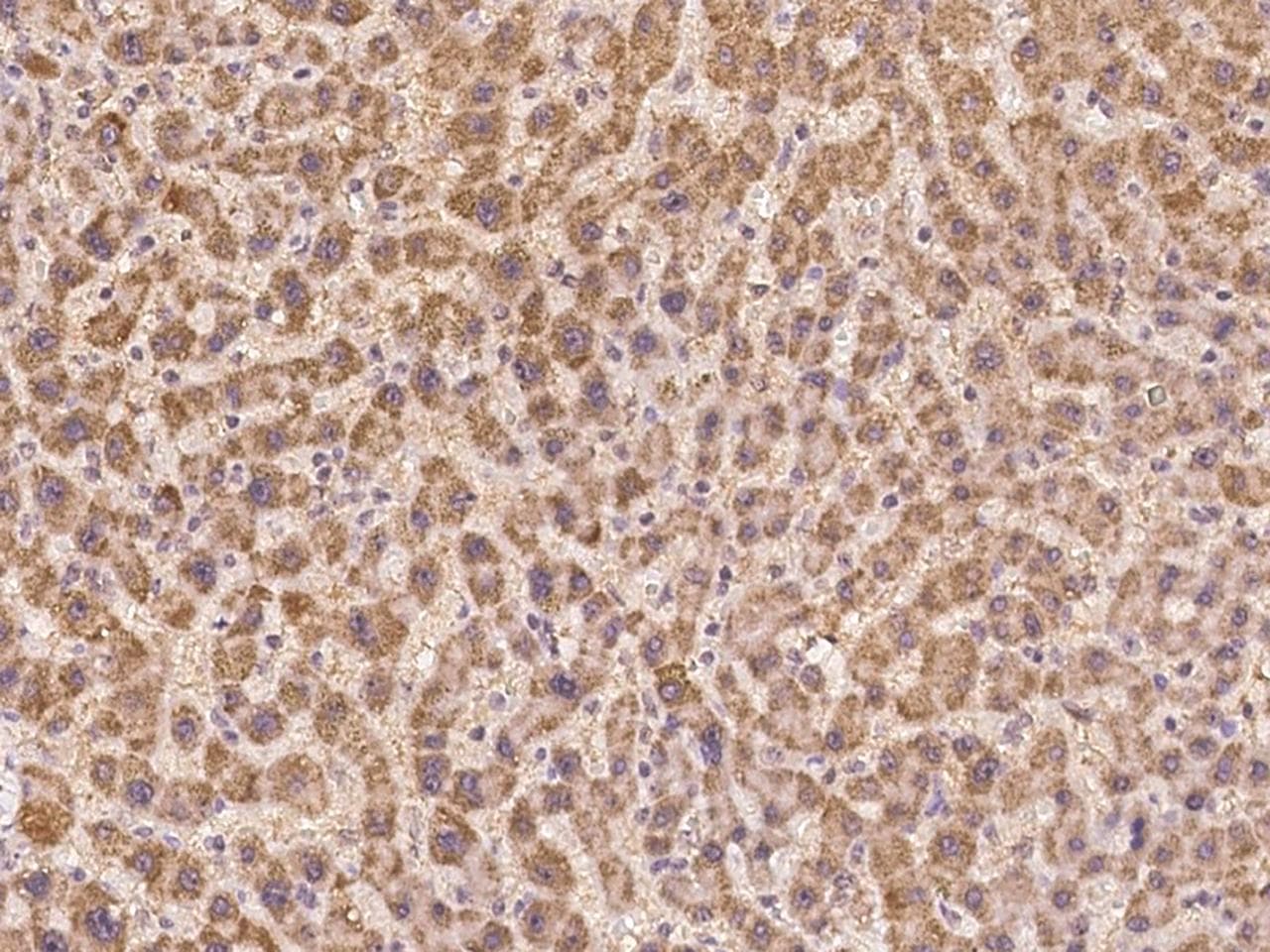 PRSS23 Antibody