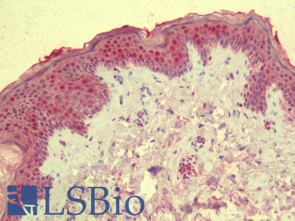 IHC-plus™ KIAA0692 / ANKLE2 Antibody