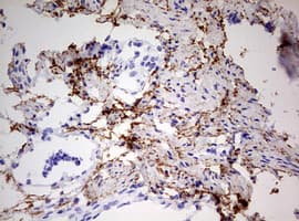 RIPK3 / RIP3 Antibody (aa233-518, clone OTI2B10)
