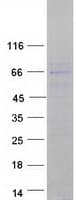 Human CNOT6L Protein (Recombinant Myc-DDK (Flag))