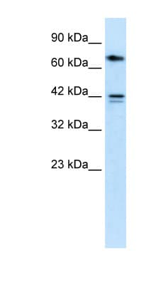 CACNB1 Antibody (aa21-70)